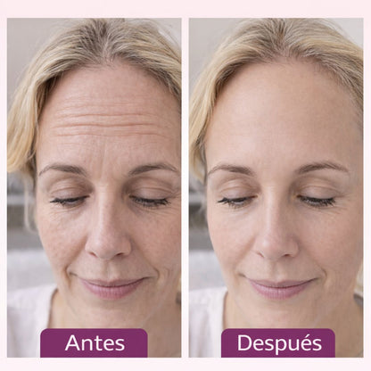LIFT STICK PRO-El Stick Efecto Lifting Que Reduce Visiblemente Las Arrugas En Días